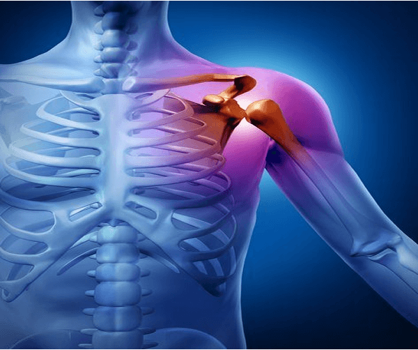 Minimally invasive shoulder surgery in guadalajara